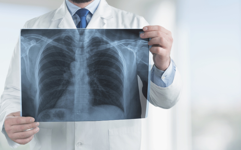 COPD and Exercise Tips for Staying Active and Improving Lung Function COPD and Exercise: Tips for Staying Active and Improving Lung Function